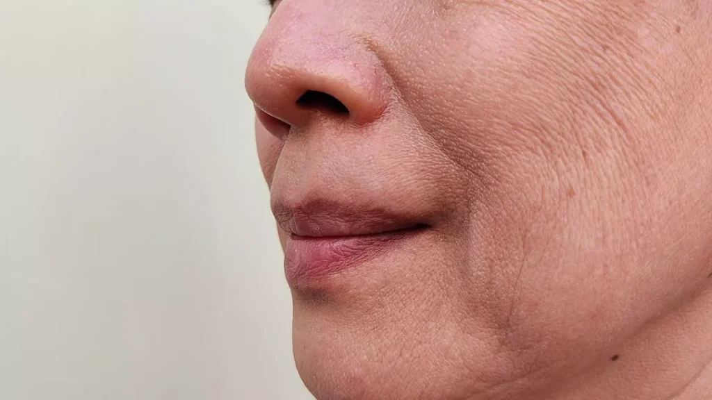 زدن روغن زیتون به صورت قبل از خواب چه فایدهای دارد؟ 8 صورتی زنانه با خطوط ریز روی آن